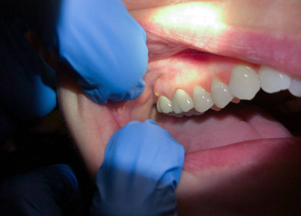 Best Emergency TMJ Treatment in Lake Hamilton, FL
